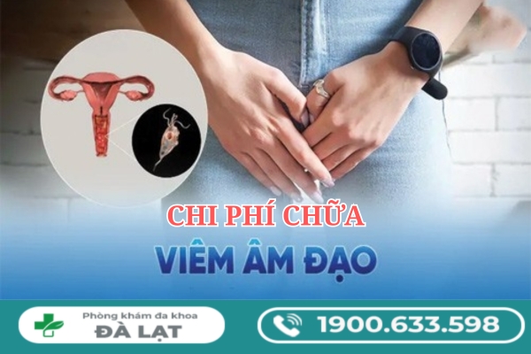 Hình ảnh minh họa